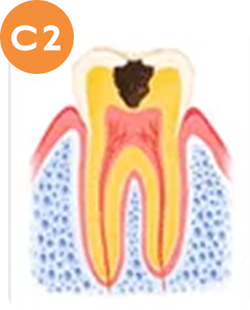 C2